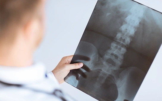 View Over-The-Shoulder Of A Doctor In A Lab Coat Reading An X-Ray