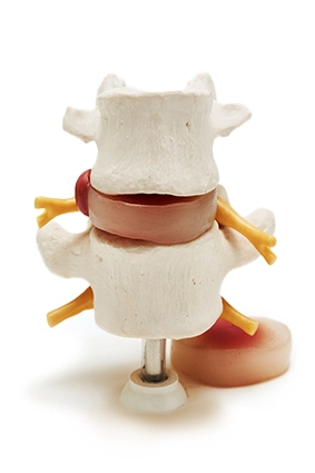 Model Of A Spinal Vertebra On A White Background